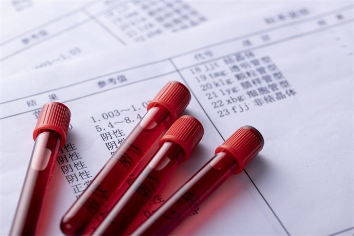 关于这次延迟更新说明：阳了【2022年12月21日】